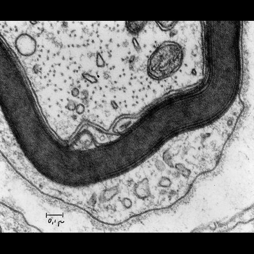  NCBI Organism:Rattus; Cell Types:myelinating Schwann cell Cell Components:myelin sheath, mitochondrion, microtubule; Biological process:transmission of nerve impulse