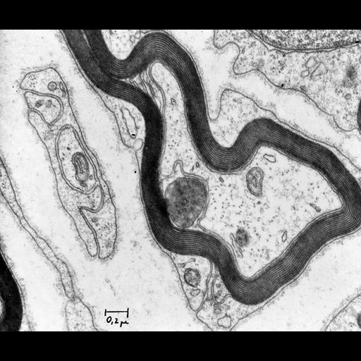  NCBI Organism:Rattus; Cell Types:neuron Cell Components:myelin sheath, microtubule; Biological process:transmission of nerve impulse