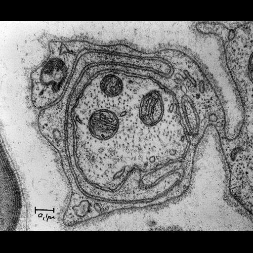  NCBI Organism:Rattus; Cell Types:non-myelinating Schwann cell Cell Components:microtubule, mitochondrion, mitochondrial outer membrane, extrinsic to mitochondrial inner membrane, cell outer membrane, axon; Biological process:transmission of nerve impulse