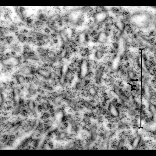  Cell Types:neuron Cell Components:, rough endoplasmic reticulum; Biological process:cytoplasm organization