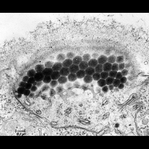  NCBI Organism:Chlamydomonas; Cell Components:chloroplast, , , carotenoid vesicle, pigment granule; Biological process:organelle organization, phototaxis;