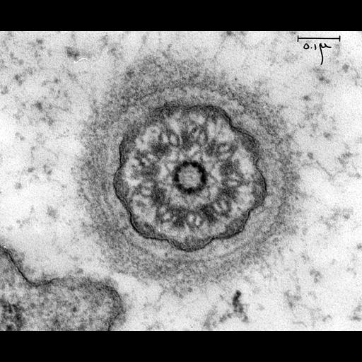  NCBI Organism:Chlamydomonas reinhardtii; Cell Components:flagellum, axoneme; Biological process:flagellum organization, ciliary or flagellar motility;