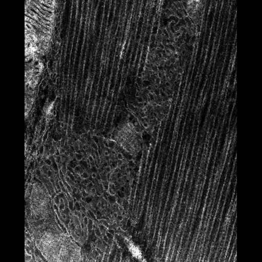  Cell Types:flight muscle cell Cell Components:myofibril, mitochondrion, sarcoplasmic reticulum, T-tubule; Biological process:skeletal muscle contraction, mitochondrial proton-transporting ATP synthase complex assembly, sequestering of calcium ion, membrane depolarization;