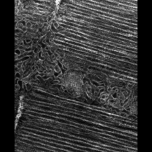  Cell Types:flight muscle cell Cell Components:myofibril, mitochondrion, sarcoplasmic reticulum, T-tubule; Biological process:skeletal muscle contraction, mitochondrial proton-transporting ATP synthase complex assembly, sequestering of calcium ion, membrane depolarization;