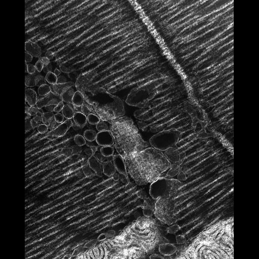  Cell Types:flight muscle cell Cell Components:myofibril, mitochondrion, sarcoplasmic reticulum, T-tubule; Biological process:skeletal muscle contraction, mitochondrial proton-transporting ATP synthase complex assembly, sequestering of calcium ion, membrane depolarization;