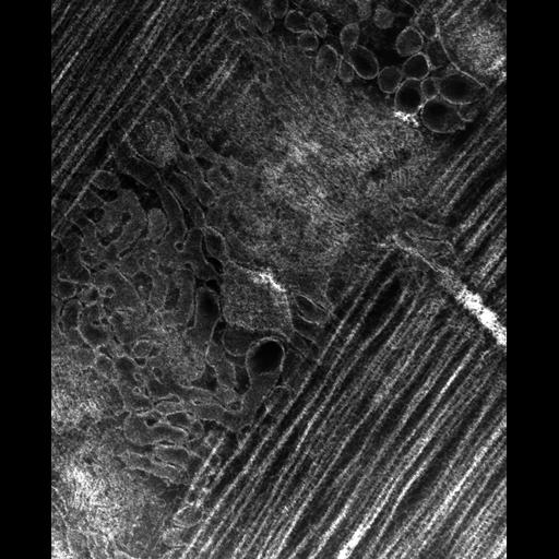  Cell Types:flight muscle cell Cell Components:myofibril, mitochondrion, sarcoplasmic reticulum, T-tubule; Biological process:skeletal muscle contraction, mitochondrial proton-transporting ATP synthase complex assembly, sequestering of calcium ion, membrane depolarization;