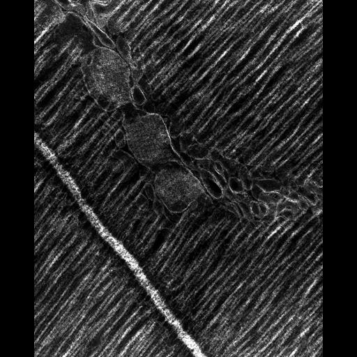  Cell Types:flight muscle cell Cell Components:myofibril, mitochondrion, sarcoplasmic reticulum, T-tubule; Biological process:skeletal muscle contraction, mitochondrial proton-transporting ATP synthase complex assembly, sequestering of calcium ion, membrane depolarization;