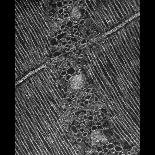  Cell Types:flight muscle cell Cell Components:myofibril, mitochondrion, sarcoplasmic reticulum, T-tubule; Biological process:skeletal muscle contraction, mitochondrial proton-transporting ATP synthase complex assembly, sequestering of calcium ion, membrane depolarization;