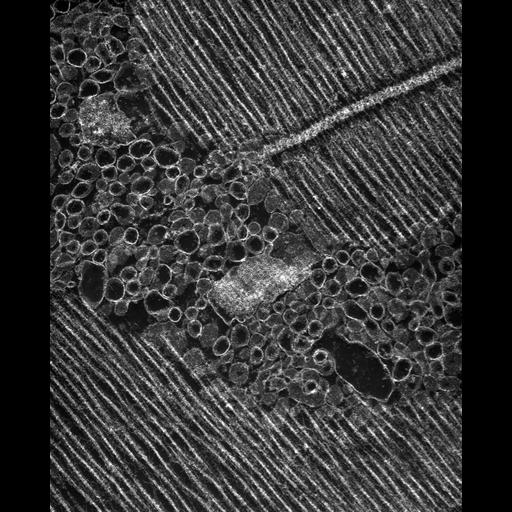  Cell Types:flight muscle cell Cell Components:myofibril, mitochondrion, sarcoplasmic reticulum, T-tubule; Biological process:skeletal muscle contraction, mitochondrial proton-transporting ATP synthase complex assembly, sequestering of calcium ion, membrane depolarization;