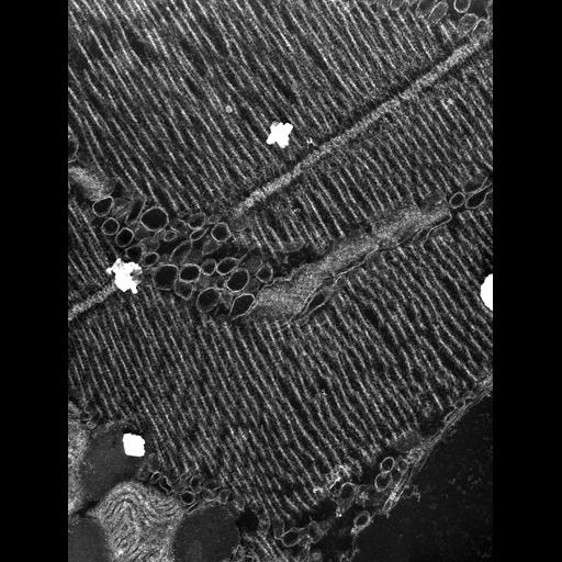  Cell Types:flight muscle cell Cell Components:myofibril, mitochondrion, sarcoplasmic reticulum, T-tubule; Biological process:skeletal muscle contraction, mitochondrial proton-transporting ATP synthase complex assembly, sequestering of calcium ion, membrane depolarization;