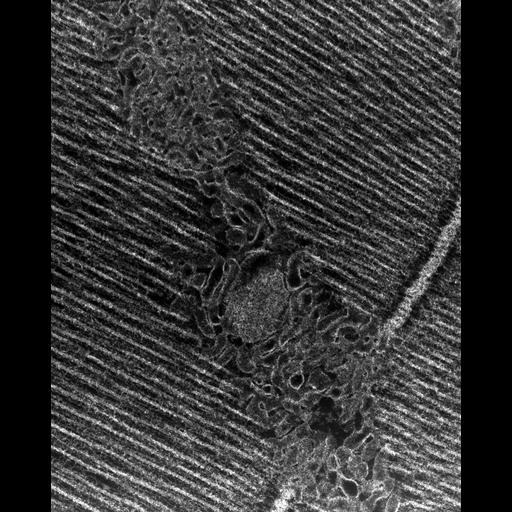  Cell Types:flight muscle cell Cell Components:myofibril, mitochondrion, sarcoplasmic reticulum, T-tubule; Biological process:skeletal muscle contraction, mitochondrial proton-transporting ATP synthase complex assembly, sequestering of calcium ion, membrane depolarization;