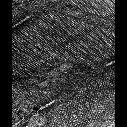  Cell Types:flight muscle cell Cell Components:myofibril, mitochondrion, sarcoplasmic reticulum, T-tubule; Biological process:skeletal muscle contraction, mitochondrial proton-transporting ATP synthase complex assembly, sequestering of calcium ion, membrane depolarization;