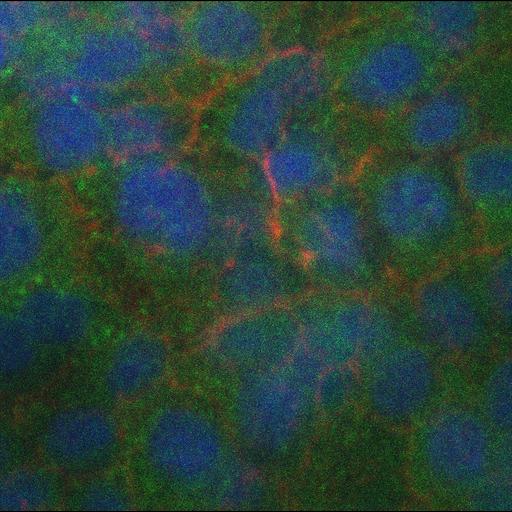  NCBI Organism:Homo sapiens; Cell Types:epithelial cell Cell Components:cortical actin cytoskeleton, nucleus; Biological process:apoptotic process, actomyosin structure organization;