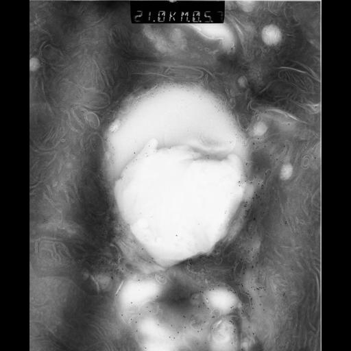  NCBI Organism:Rattus rattus; Cell Types:, glandular epithelial cell, milk secreting cell; Cell Components:smooth endoplasmic reticulum, lipid particle, trans-Golgi network, mitochondrion; Biological process:lipid storage, lactation, secretion;