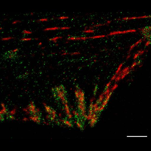  NCBI Organism:Homo sapiens; Cell Types:fibroblast Cell Components:focal adhesion, actin cytoskeleton, , ; Biological process:, focal adhesion assembly;