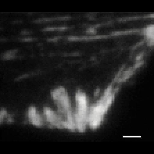  NCBI Organism:Homo sapiens; Cell Types:fibroblast Cell Components:focal adhesion, actin cytoskeleton, , ; Biological process:focal adhesion assembly