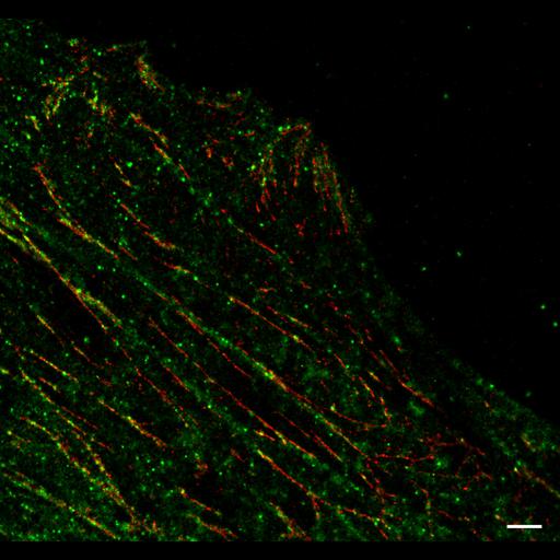  NCBI Organism:Homo sapiens; Cell Types:fibroblast Cell Components:focal adhesion, actin cytoskeleton, ; Biological process:, focal adhesion assembly;