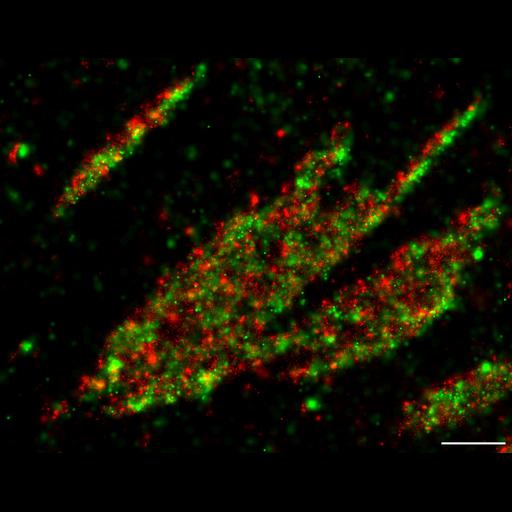  NCBI Organism:Homo sapiens; Cell Types:fibroblast Cell Components:focal adhesion, , ; Biological process:, focal adhesion assembly;