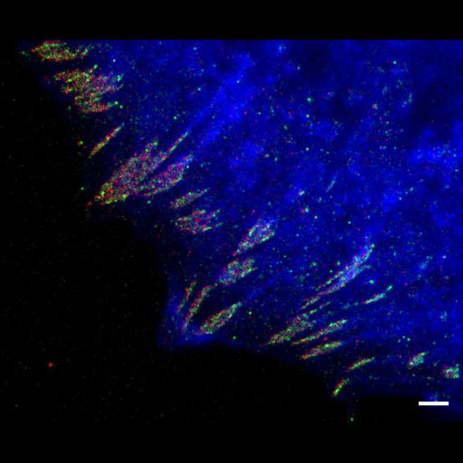  NCBI Organism:Homo sapiens; Cell Types:fibroblast Cell Components:focal adhesion, actin cytoskeleton, , ;