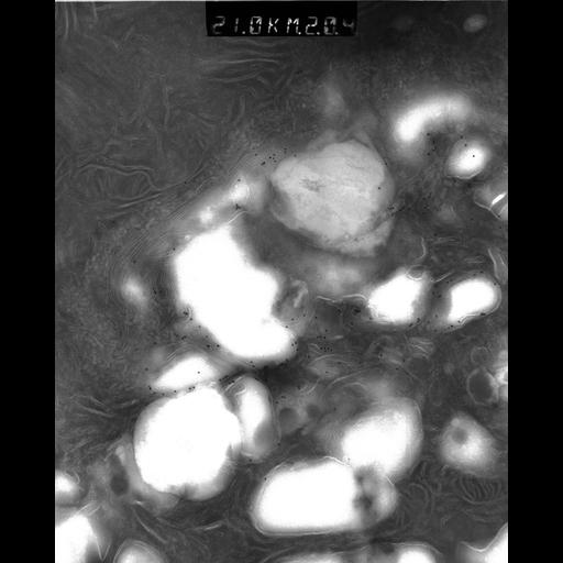  NCBI Organism:Rattus rattus; Cell Types:, glandular epithelial cell, milk secreting cell; Cell Components:smooth endoplasmic reticulum, lipid particle, trans-Golgi network, mitochondrion; Biological process:lipid storage, lactation, secretion;