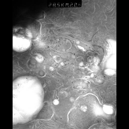  NCBI Organism:Rattus rattus; Cell Types:, glandular epithelial cell, milk secreting cell; Cell Components:smooth endoplasmic reticulum, lipid particle, trans-Golgi network, mitochondrion; Biological process:lipid storage, lactation, secretion;