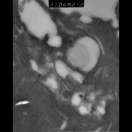  NCBI Organism:Rattus rattus; Cell Types:, glandular epithelial cell, milk secreting cell; Cell Components:smooth endoplasmic reticulum, lipid particle, trans-Golgi network, mitochondrion; Biological process:lipid storage, lactation, secretion;