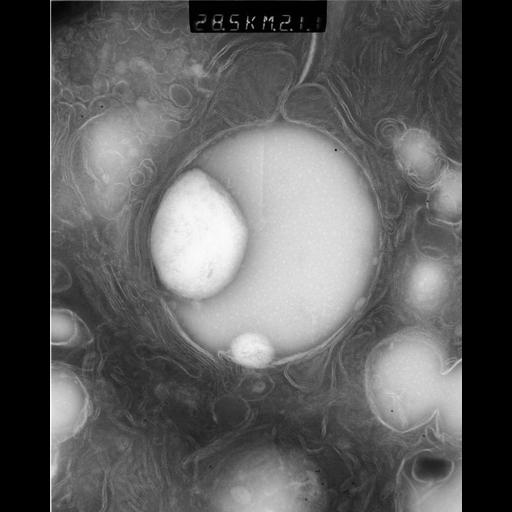  NCBI Organism:Rattus rattus; Cell Types:, glandular epithelial cell, milk secreting cell; Cell Components:smooth endoplasmic reticulum, lipid particle, trans-Golgi network, mitochondrion; Biological process:lipid storage, lactation, secretion;