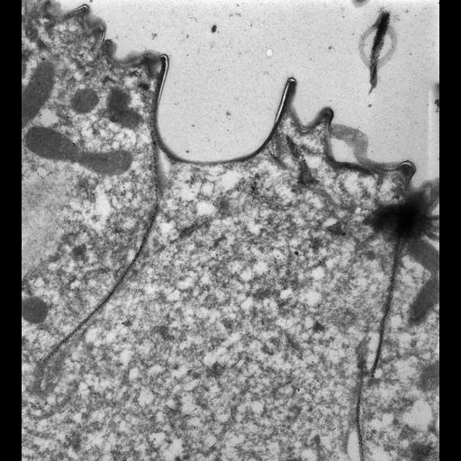  NCBI Organism:Paramecium tetraurelia; Cell Types:cell by organism, eukaryotic cell, , ; Cell Components:cell cortex, contractile vacuole pore, cortical microtubule; Biological process:microtubule cytoskeleton organization, , cortical cytoskeleton organization, cortical microtubule organization;