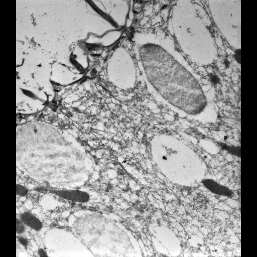  NCBI Organism:Paramecium tetraurelia; Cell Types:cell by organism, eukaryotic cell, , ; Cell Components:cell cortex, cortical microtubule cytoskeleton, cortical microtubule, microtubule basal body, trichocyst; Biological process:microtubule cytoskeleton organization, microtubule basal body organization, cortical microtubule organization;