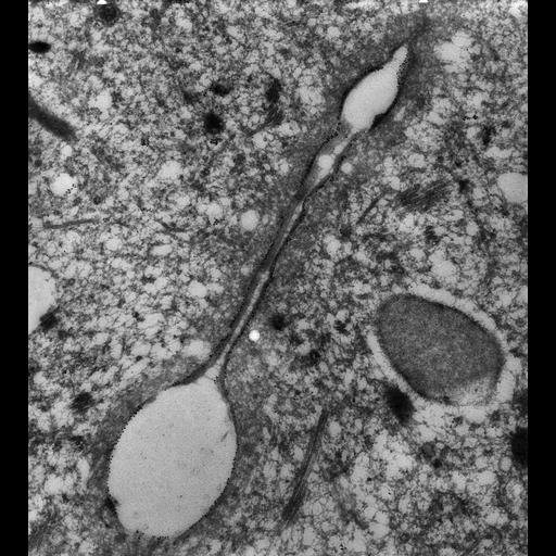  NCBI Organism:Paramecium tetraurelia; Cell Types:cell by organism, eukaryotic cell, , ; Cell Components:contractile vacuole, contractile vacuolar membrane, cytoplasmic microtubule; Biological process:microtubule cytoskeleton organization, contractile vacuole organization;