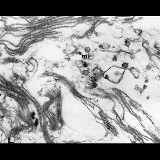  NCBI Organism:Chlamydomonas reinhardtii; Cell Components:chloroplast, plastid, plastid thylakoid membrane; Biological process:photosynthesis, organelle organization;