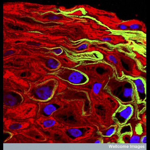  NCBI Organism:Homo sapiens; Cell Types:epithelial cell Cell Components:keratin filament, , nucleus; Biological process:initiation of viral infection