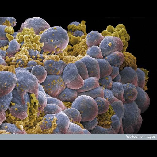  Cell Components:cell surface Biological process:apoptotic process