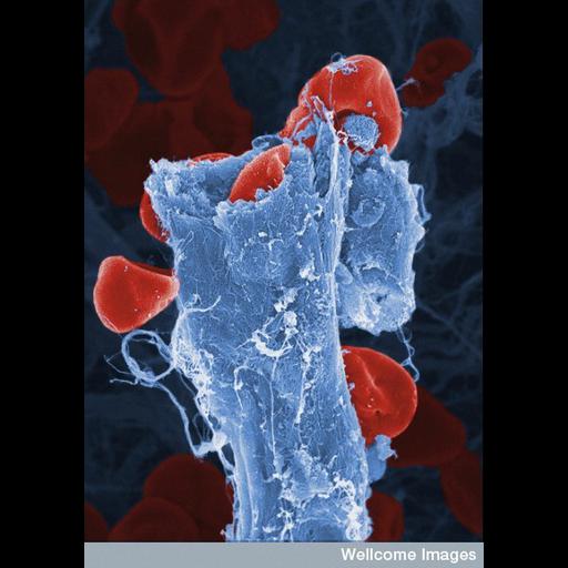  Cell Types:blood cell Biological process:, , ;