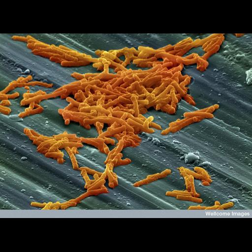  NCBI Organism:Clostridium difficile; Cell Components:cell surface