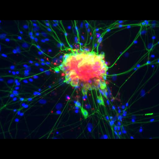  NCBI Organism:Mus musculus; Cell Types:, neuron of the dorsal spinal cord;