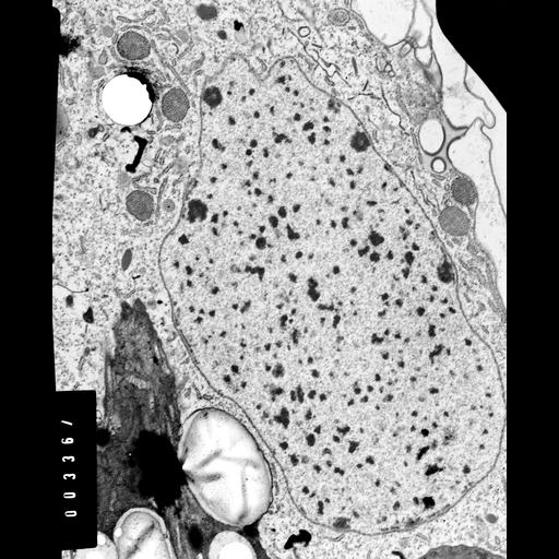  NCBI Organism:Coleps hirtus; Cell Types:eukaryotic cell, , ; Cell Components:macronucleus, nuclear pore, heterochromatin, nucleolus; Biological process:macronucleus organization, nuclear pore organization, chromatin organization, chromosome organization;