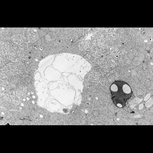  NCBI Organism:Didinium nasutum; Cell Types:cell by organism, eukaryotic cell, , ; Cell Components:contractile vacuole, smooth endoplasmic reticulum, ; Biological process:contractile vacuole organization, ;