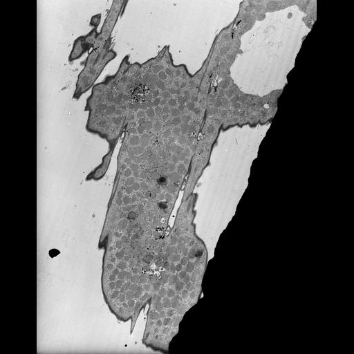  NCBI Organism:Euplotes sp.; Cell Types:cell by organism, eukaryotic cell, , ; Cell Components:cilium, mitochondrion, ; Biological process:auditory receptor cell stereocilium organization, cytoplasm organization, ;