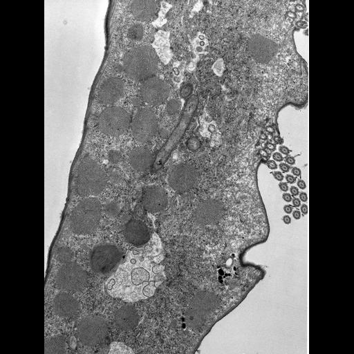  NCBI Organism:Euplotes sp.; Cell Types:cell by organism, eukaryotic cell, , ; Cell Components:cytoplasm, symbiont-containing vacuole, ; Biological process:cytoplasm organization, detection of symbiont, ;