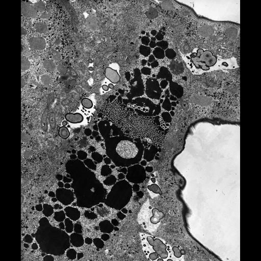  NCBI Organism:Euplotes sp.; Cell Types:cell by organism, eukaryotic cell, , ; Cell Components:cytoplasm, macronucleus, food vacuole, contractile vacuole; Biological process:macronucleus organization, cytoplasm organization, ;