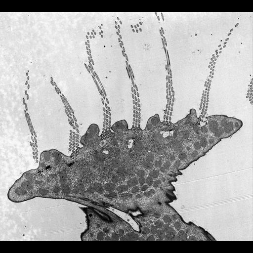  NCBI Organism:Euplotes sp.; Cell Types:cell by organism, eukaryotic cell, , ; Cell Components:oral apparatus, mitochondrion; Biological process:oral/aboral axis specification, oral apparatus organization, cytoplasm organization;