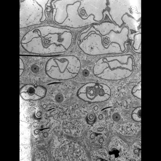  NCBI Organism:Paramecium caudatum; Cell Types:cell by organism, eukaryotic cell, , ; Cell Components:cell cortex, , cortical cytoskeleton, cilium, microtubule basal body; Biological process:plasma membrane organization, cortical cytoskeleton organization;