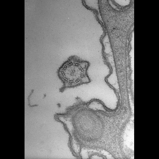  NCBI Organism:Paramecium caudatum; Cell Types:cell by organism, eukaryotic cell, , ; Cell Components:cilium, trichocyst, pellicle; Biological process:, cortical cytoskeleton organization;