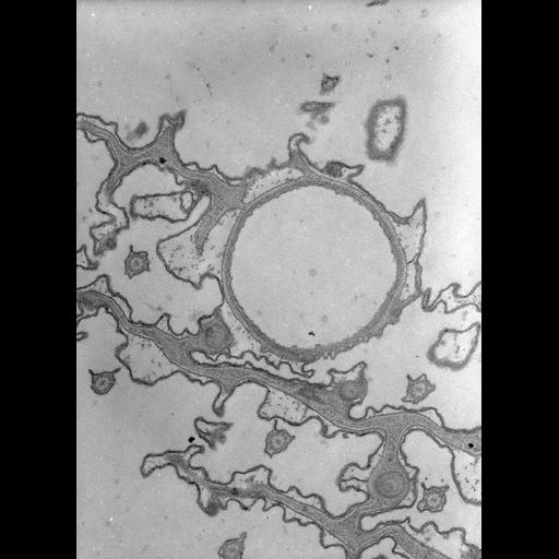  NCBI Organism:Paramecium caudatum; Cell Types:cell by organism, eukaryotic cell, , ; Cell Components:contractile vacuole pore, microtubule associated complex, , cell cortex; Biological process:contractile vacuole organization, cortical cytoskeleton organization;