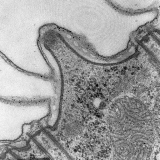  NCBI Organism:Paramecium caudatum; Cell Types:cell by organism, eukaryotic cell, , ; Cell Components:plasma membrane, pellicle, cell cortex; Biological process:plasma membrane organization, cortical cytoskeleton organization, ;