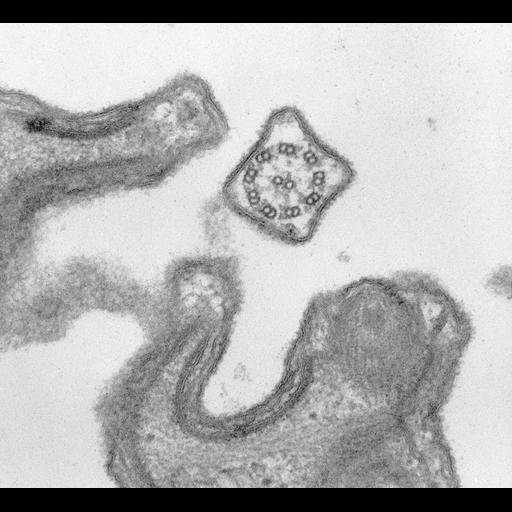  NCBI Organism:Paramecium caudatum; Cell Types:cell by organism, eukaryotic cell, , ; Cell Components:cilium, glycocalyx; Biological process:ciliary or flagellar motility, plasma membrane organization;