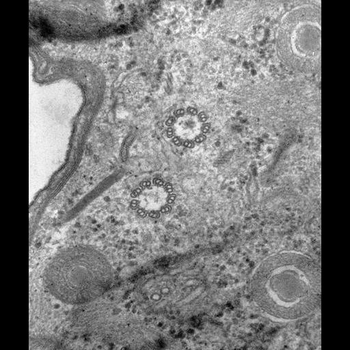  NCBI Organism:Paramecium caudatum; Cell Types:cell by organism, eukaryotic cell, , ; Cell Components:microtubule basal body, ; Biological process:microtubule basal body organization, microtubule cytoskeleton organization;