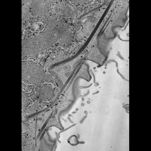  NCBI Organism:Paramecium caudatum; Cell Types:cell by organism, eukaryotic cell, , ; Cell Components:cortical microtubule cytoskeleton, , ; Biological process:cortical cytoskeleton organization