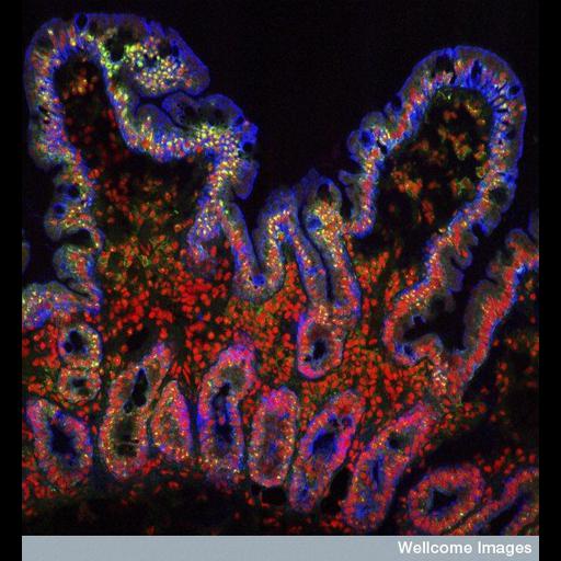  NCBI Organism:Homo sapiens; Cell Types:epithelial cell of small intestine Cell Components:plasma membrane, nucleus;